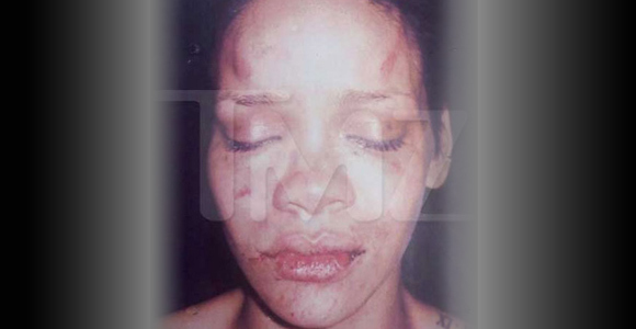 rihanna-face